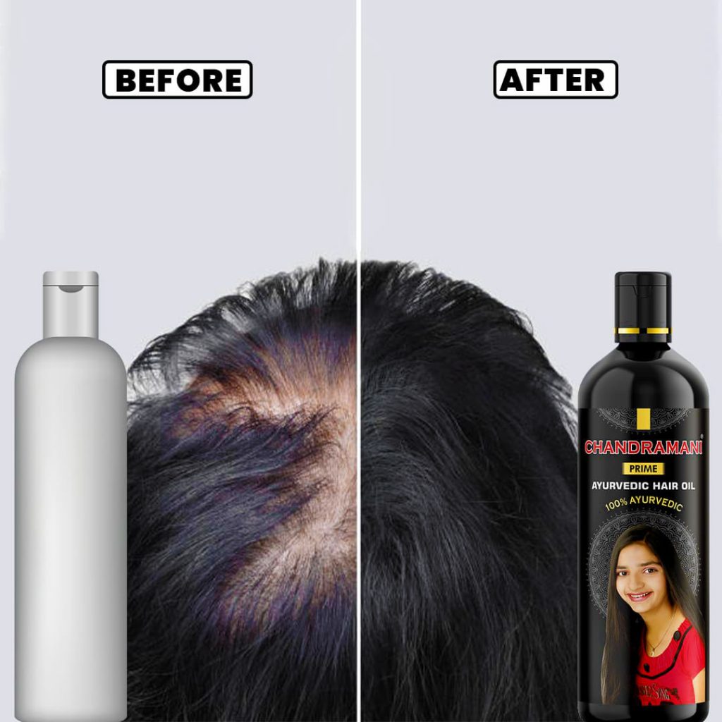 Chandramani Ayurvedic Hair Oil Combo